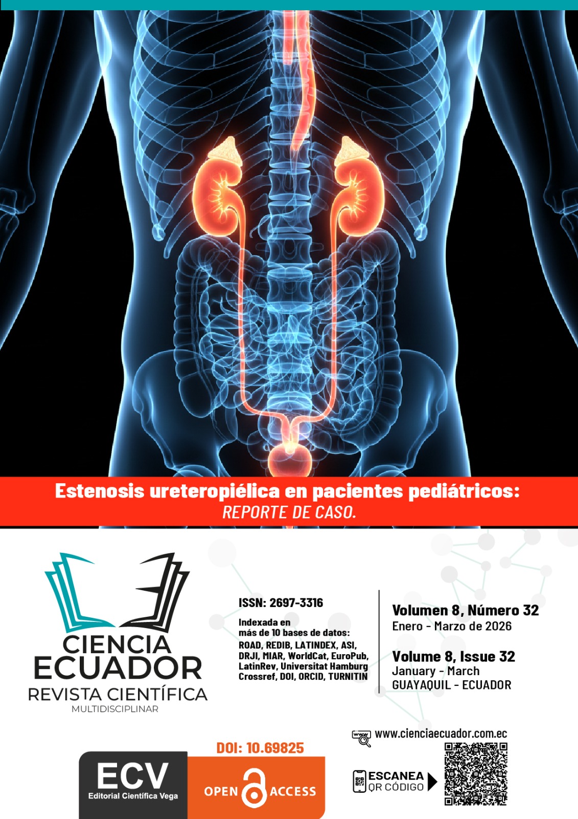 					Ver Vol. 8 Núm. 33 (2026): Desde la estenosis ureteropiélica en pacientes pediátricos: enfoque clínico y diagnóstico
				